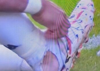 Payet sofre lesão na perna durante partida contra o Criciúma no 1º tempo; confira