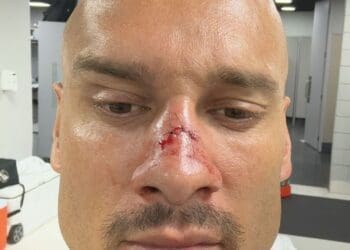 Mesmo com uma fratura no nariz, Maicon deve ser convocado para o jogo contra o Urubu.