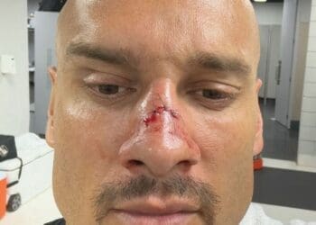 Com nariz fraturado, Maicon será convocado para a partida contra o Urubu.