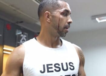 Jogo do Vasco com jogador machucado.