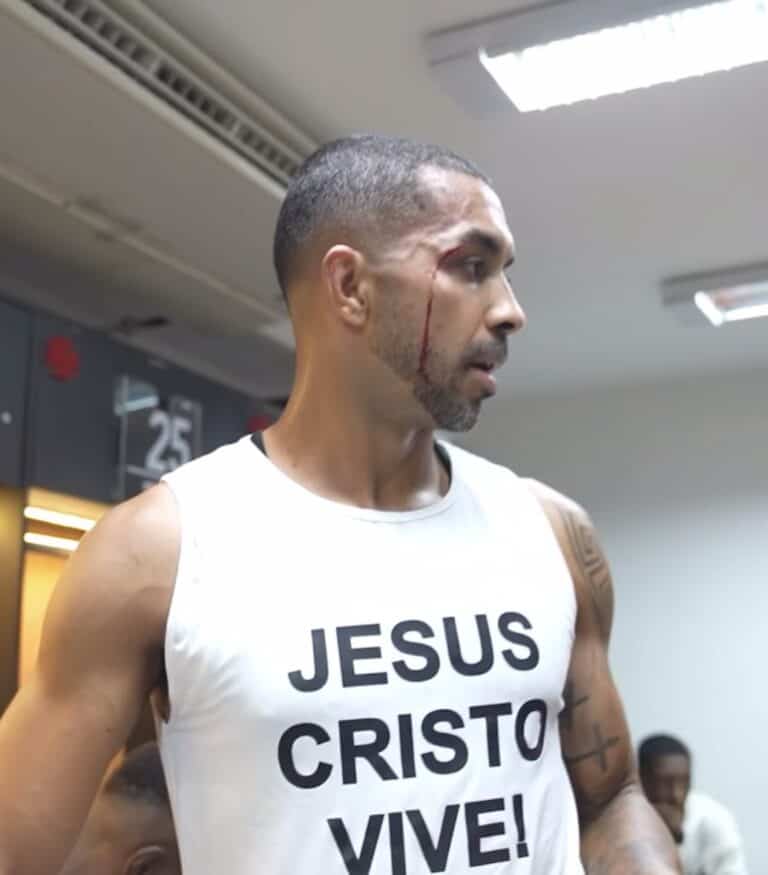 Jogo do Vasco com jogador machucado.