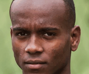 Rosto de jovem com expressão séria.