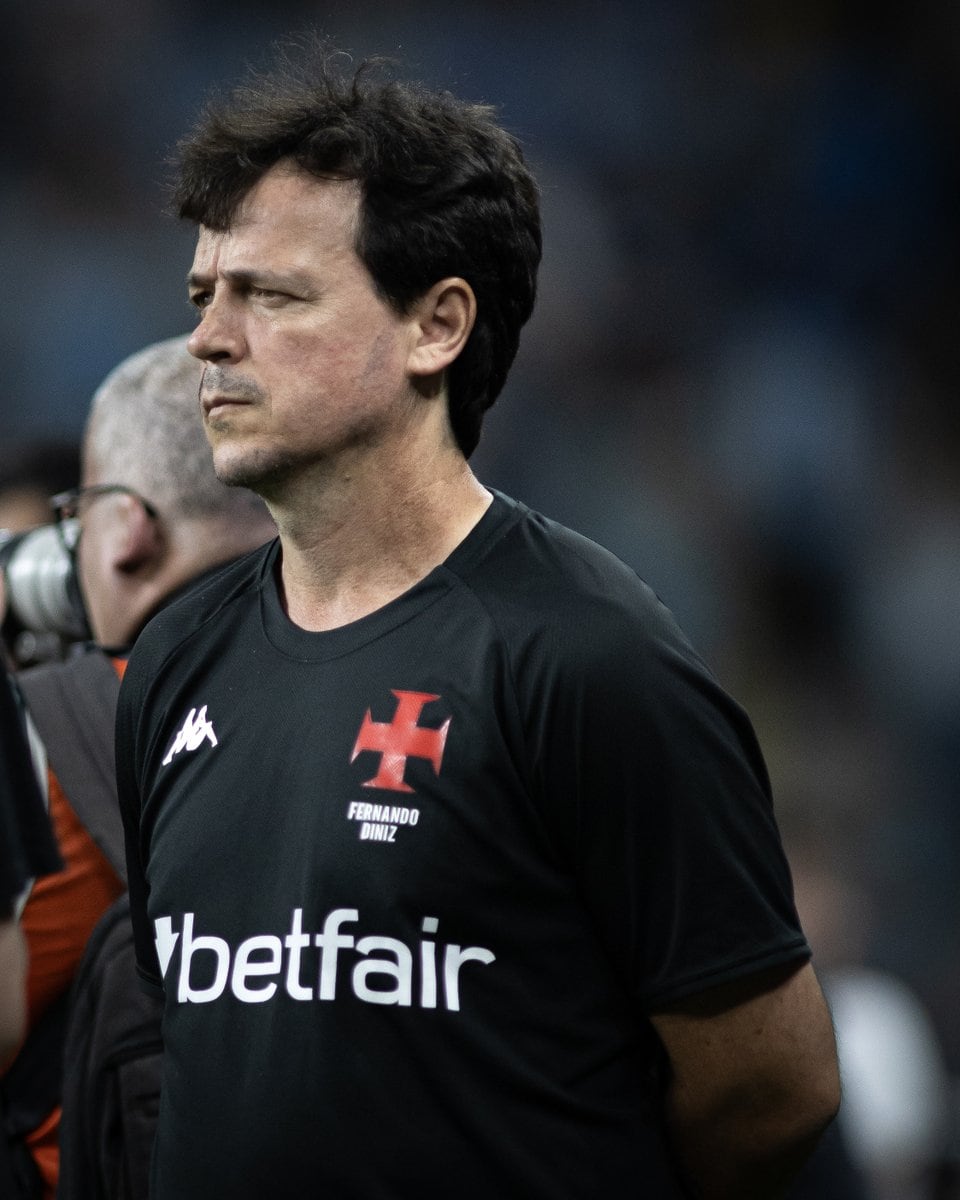 1. Técnico do Vasco com expressão séria.
