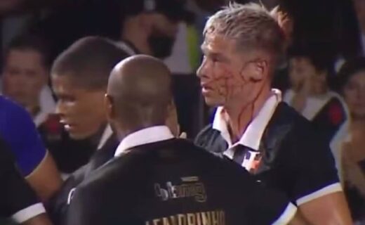 Capasso sangra muito após cotovelada