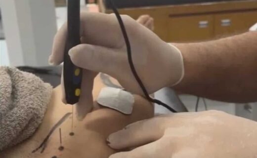 Medel realiza tratamento para dores na virilha